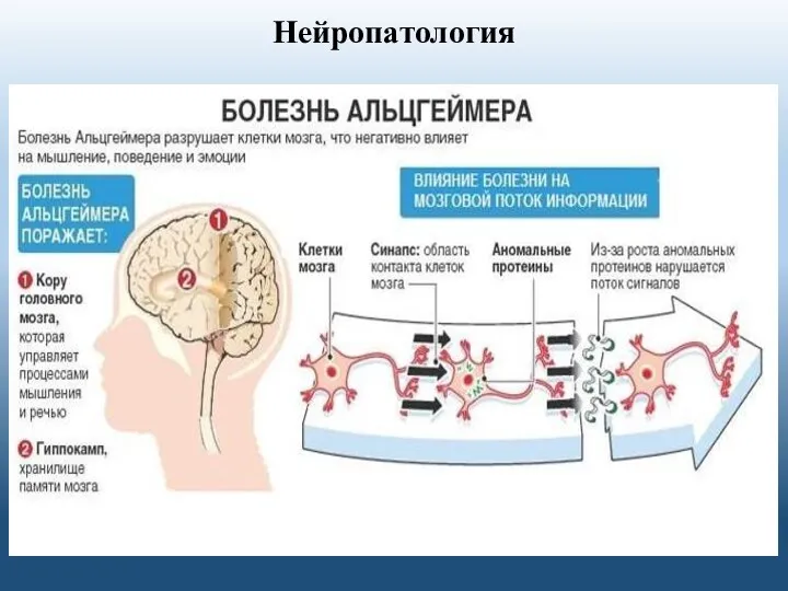 Нейропатология