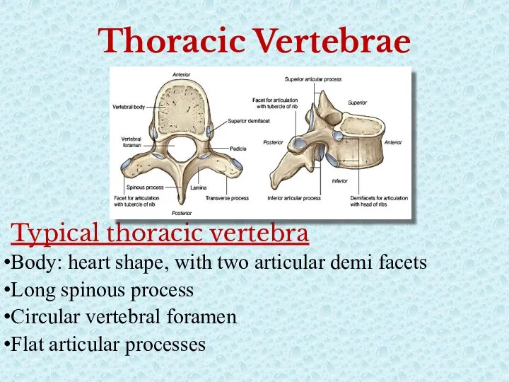 Thoracic Vertebrae Typical thoracic vertebra Body: heart shape, with two