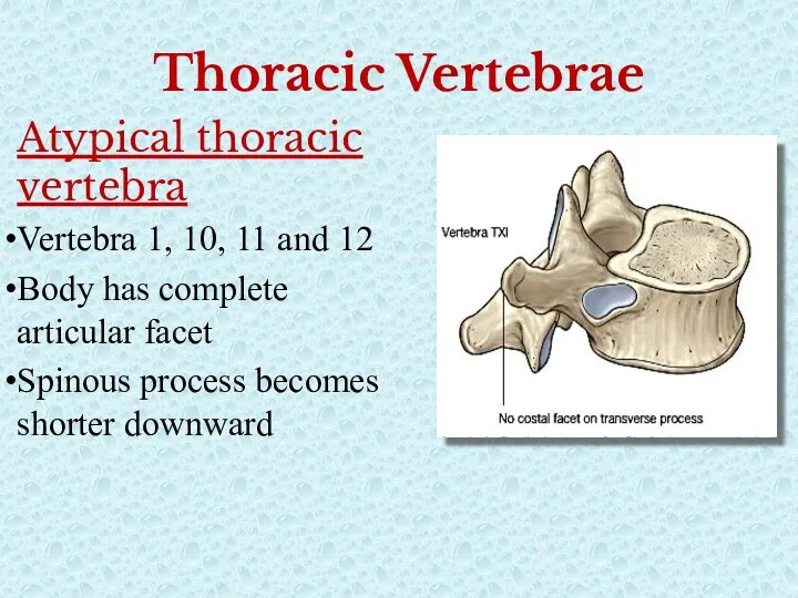 Thoracic Vertebrae Atypical thoracic vertebra Vertebra 1, 10, 11 and