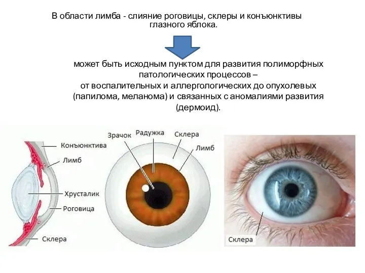 В области лимба - слияние роговицы, склеры и конъюнктивы глазного