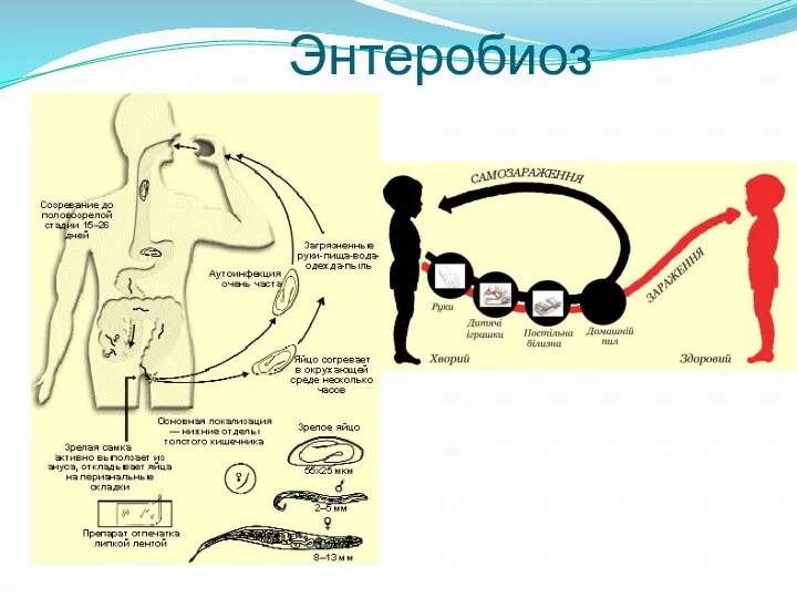 Энтеробиоз