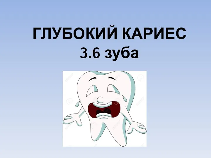 ГЛУБОКИЙ КАРИЕС 3.6 зуба
