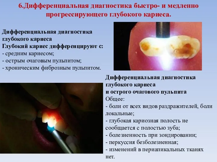 6.Дифференциальная диагностика быстро- и медленно прогрессирующего глубокого кариеса. Дифференциальная диагностика глубокого кариеса Глубокий