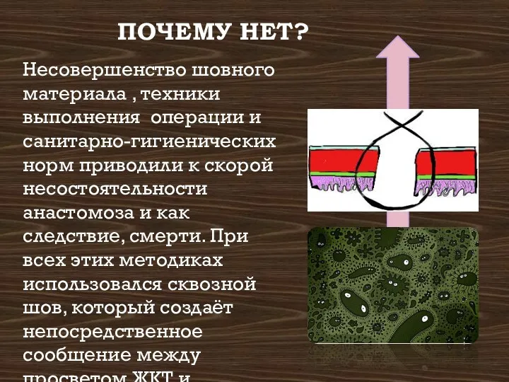 ПОЧЕМУ НЕТ? Несовершенство шовного материала , техники выполнения операции и