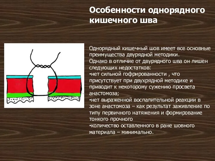 Особенности однорядного кишечного шва Однорядный кишечный шов имеет все основные преимущества двурядной методики.