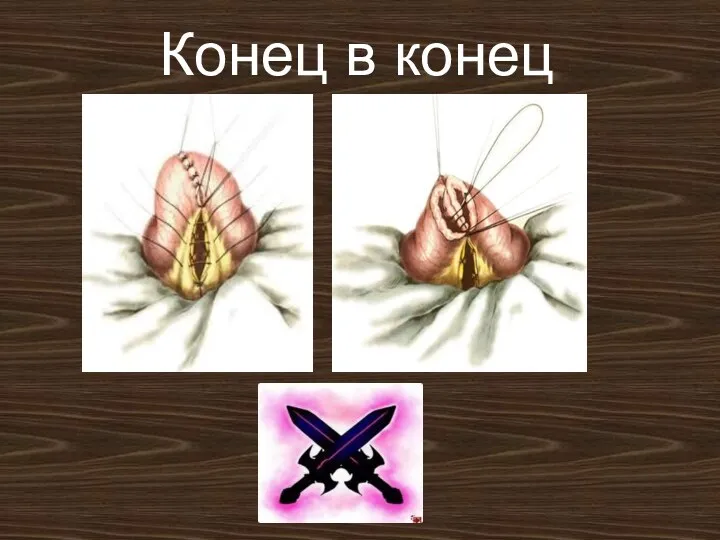 Конец в конец