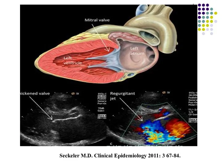 Seckeler M.D. Clinical Epidemiology 2011: 3 67-84.