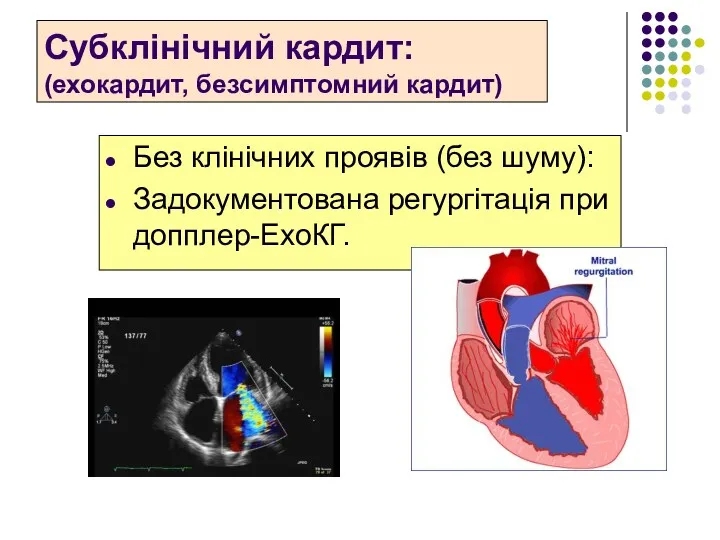 Субклінічний кардит: (ехокардит, безсимптомний кардит) Без клінічних проявів (без шуму): Задокументована регургітація при допплер-ЕхоКГ.