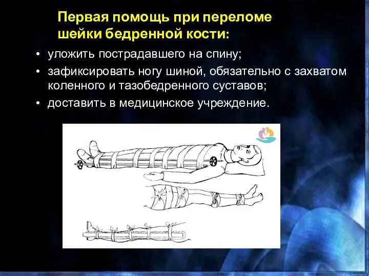 уложить пострадавшего на спину;​ зафиксировать ногу шиной, обязательно с захватом коленного и тазобедренного