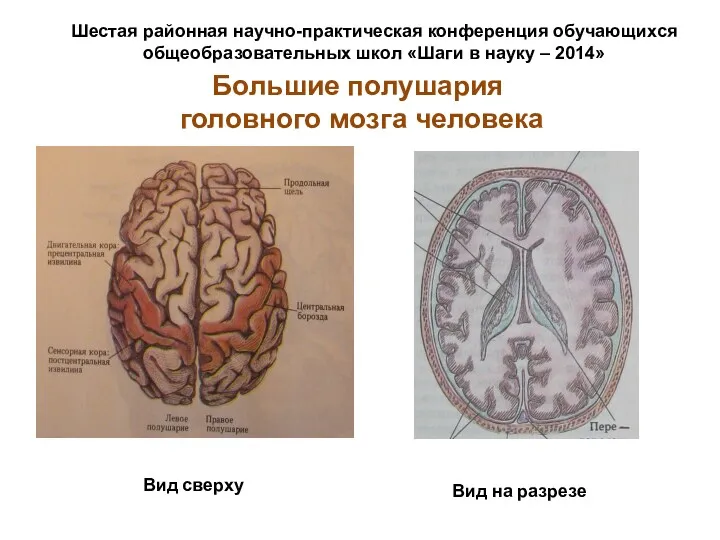 Большие полушария головного мозга человека Вид сверху Вид на разрезе