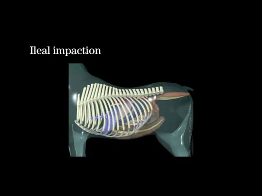 Ileal impaction