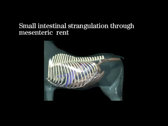 Small intestinal strangulation through mesenteric rent