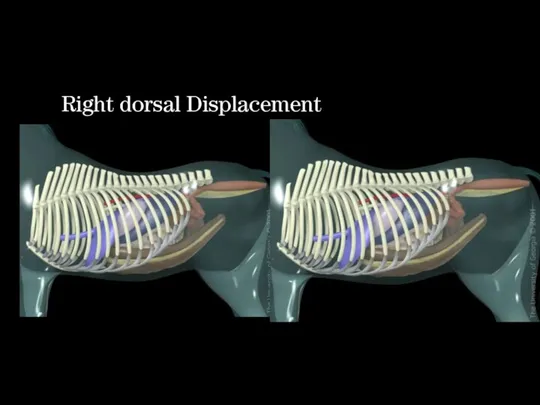 Right dorsal Displacement