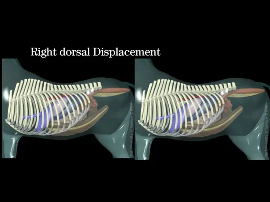 Right dorsal Displacement