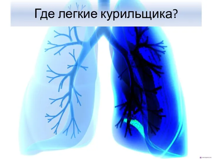 Где легкие курильщика?