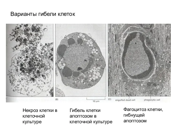Варианты гибели клеток Некроз клетки в клеточной культуре Гибель клетки апоптозом в клеточной