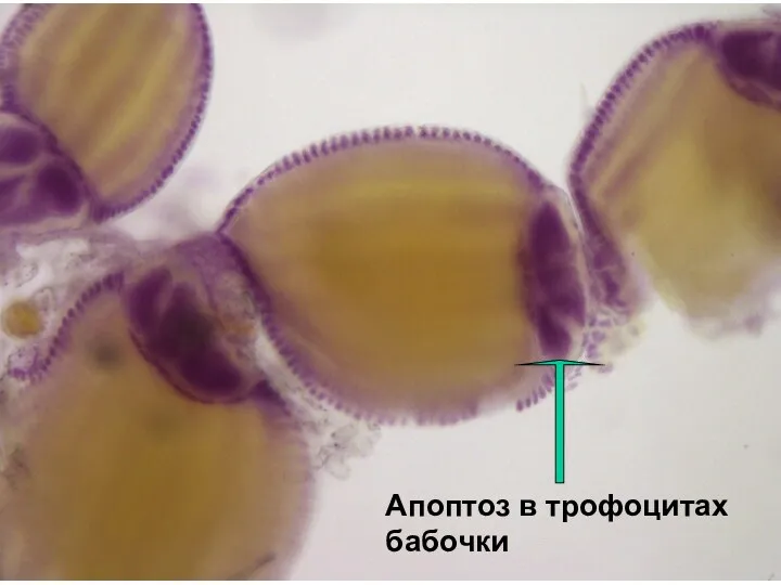 Апоптоз в трофоцитах бабочки