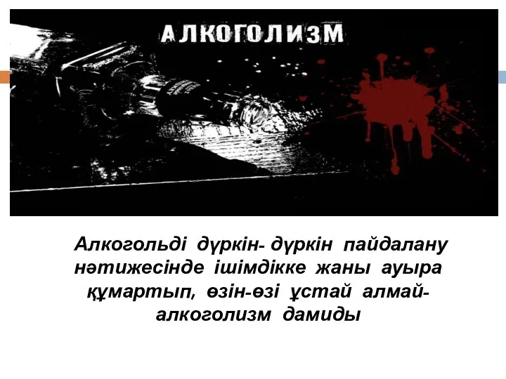 Алкогольді дүркін- дүркін пайдалану нәтижесінде ішімдікке жаны ауыра құмартып, өзін-өзі ұстай алмай- алкоголизм дамиды