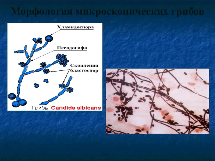 Морфология микроскопических грибов