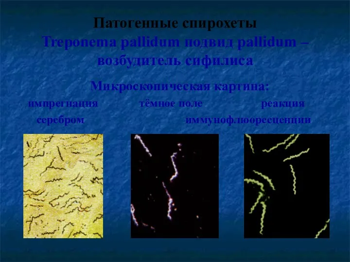 Патогенные спирохеты Treponema pallidum подвид pallidum – возбудитель сифилиса Микроскопическая