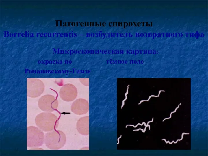 Патогенные спирохеты Borrelia recurrentis – возбудитель возвратного тифа Микроскопическая картина: окраска по тёмное поле Романовскому-Гимзе