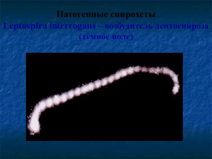 Патогенные спирохеты Leptospira interrogans – возбудитель лептоспироза (тёмное поле)