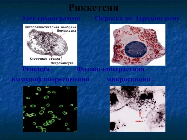 Риккетсии Электронограмма Окраска по Здродовскому Реакция Фазово-контрастная иммунофлюоресценции микроскопия