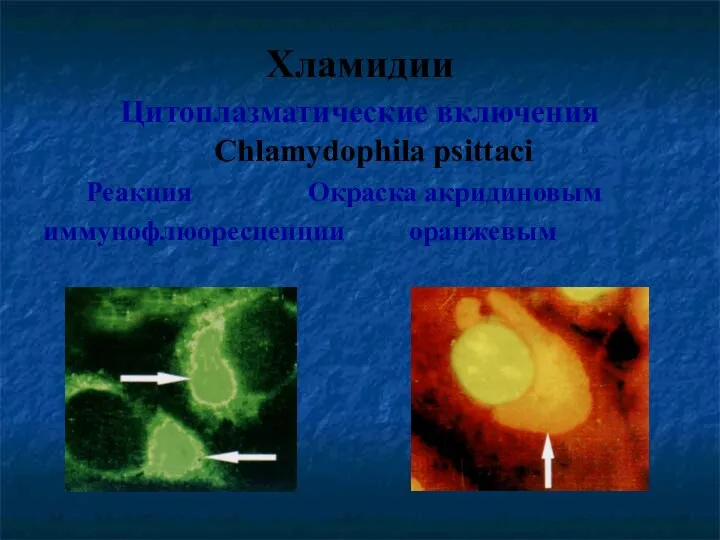 Хламидии Цитоплазматические включения Chlamydophila psittaci Реакция Окраска акридиновым иммунофлюоресценции оранжевым