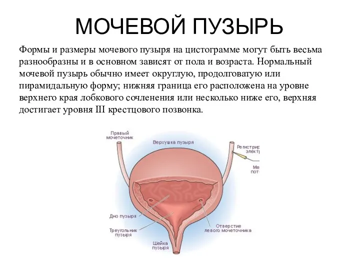 МОЧЕВОЙ ПУЗЫРЬ Формы и размеры мочевого пузыря на цистограмме могут