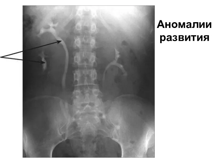 Аномалии развития