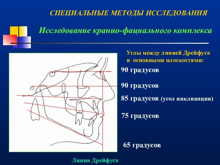 Исследование кранио-фациального комплекса . . 90 градусов 90 градусов 85