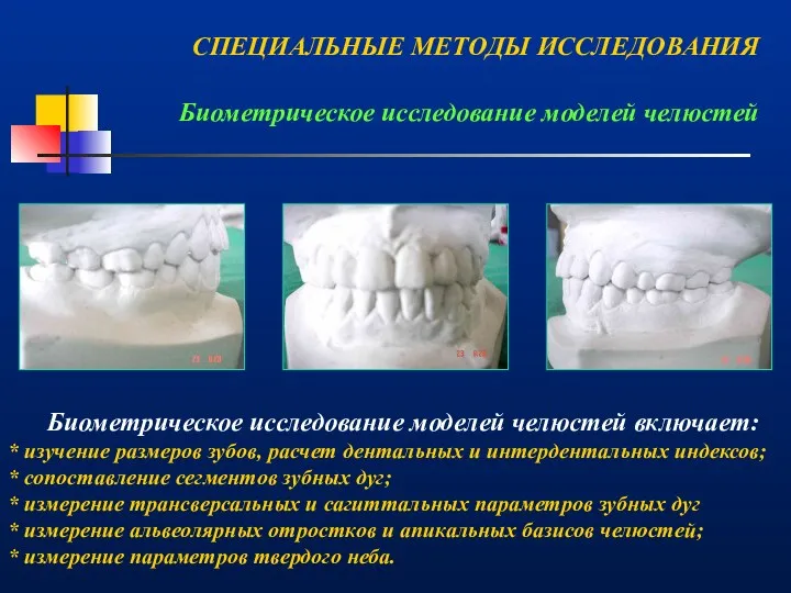 Биометрическое исследование моделей челюстей включает: * изучение размеров зубов, расчет