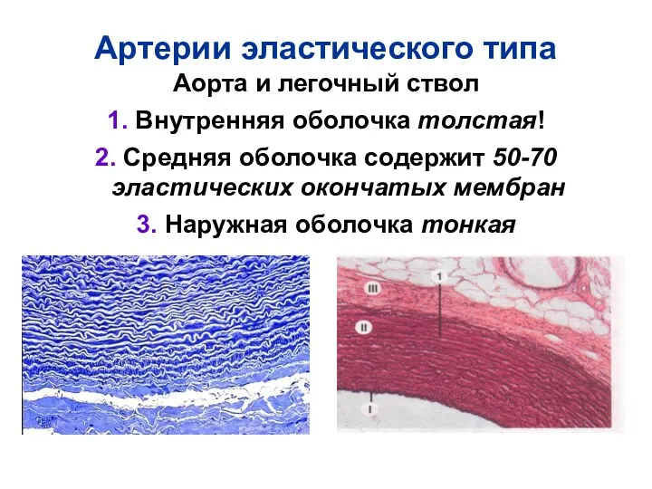 Артерии эластического типа Аорта и легочный ствол 1. Внутренняя оболочка