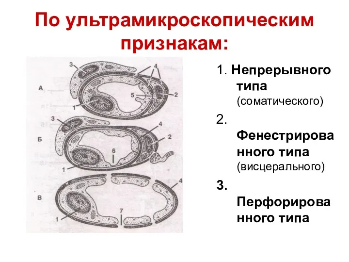 По ультрамикроскопическим признакам: 1. Непрерывного типа (соматического) 2.Фенестрированного типа (висцерального) 3.Перфорированного типа