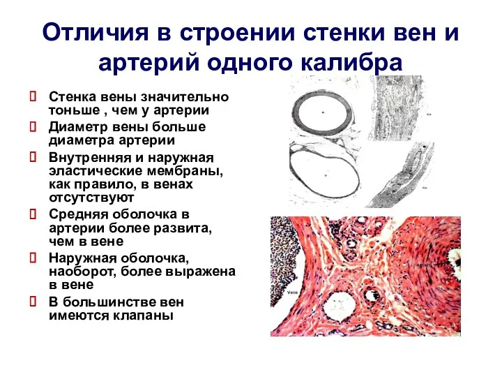 Отличия в строении стенки вен и артерий одного калибра Стенка вены значительно тоньше