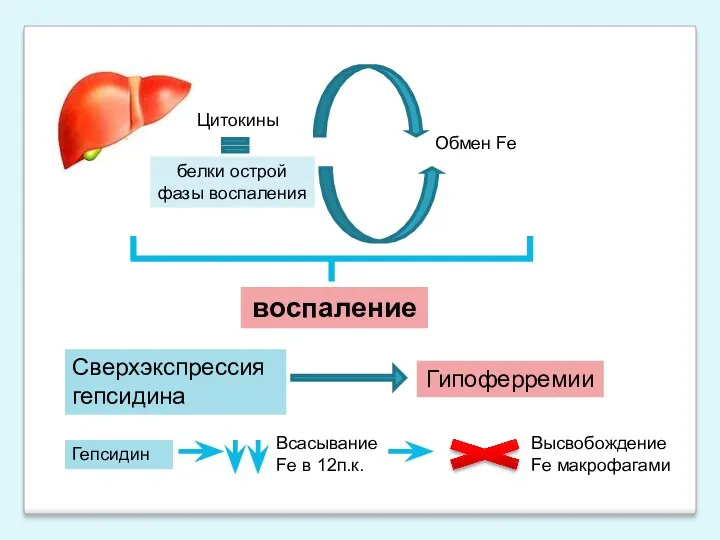 Цитокины белки острой фазы воспаления Обмен Fe воспаление Сверхэкспрессия гепсидина