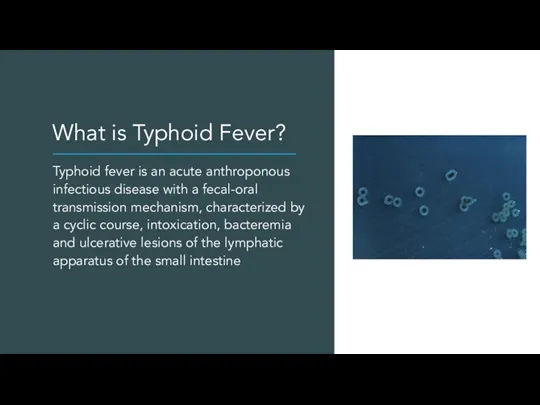 What is Typhoid Fever? Typhoid fever is an acute anthroponous