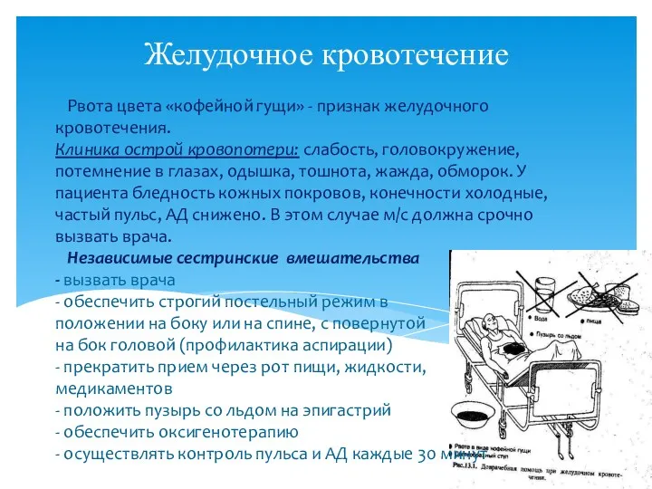 Рвота цвета «кофейной гущи» - признак желудочного кровотечения. Клиника острой