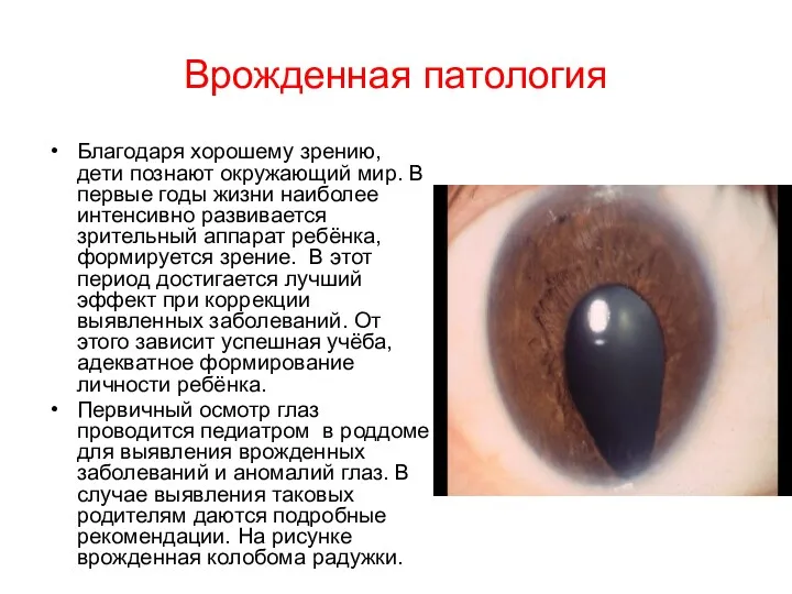 Врожденная патология Благодаря хорошему зрению, дети познают окружающий мир. В