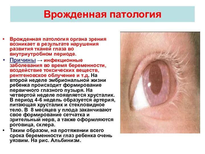 Врожденная патология Врожденная патология органа зрения возникает в результате нарушения