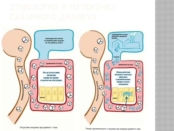 ЭТИОЛОГИЯ И ПАТОГЕНЕЗ САХАРНОГО ДИАБЕТА