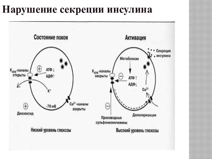 Нарушение секреции инсулина