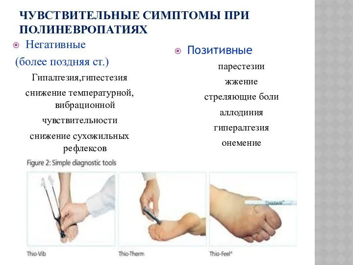 ЧУВСТВИТЕЛЬНЫЕ СИМПТОМЫ ПРИ ПОЛИНЕВРОПАТИЯХ Негативные (более поздняя ст.) Гипалгезия,гипестезия снижение