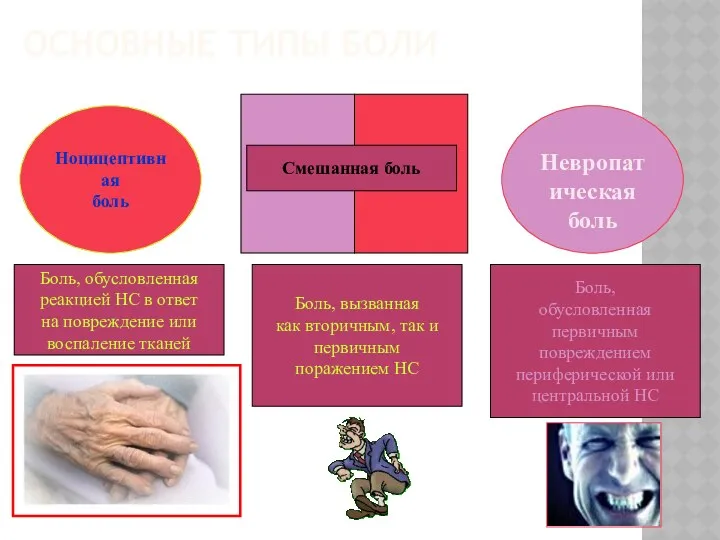 ОСНОВНЫЕ ТИПЫ БОЛИ Ноцицептивная боль Боль, обусловленная реакцией НС в