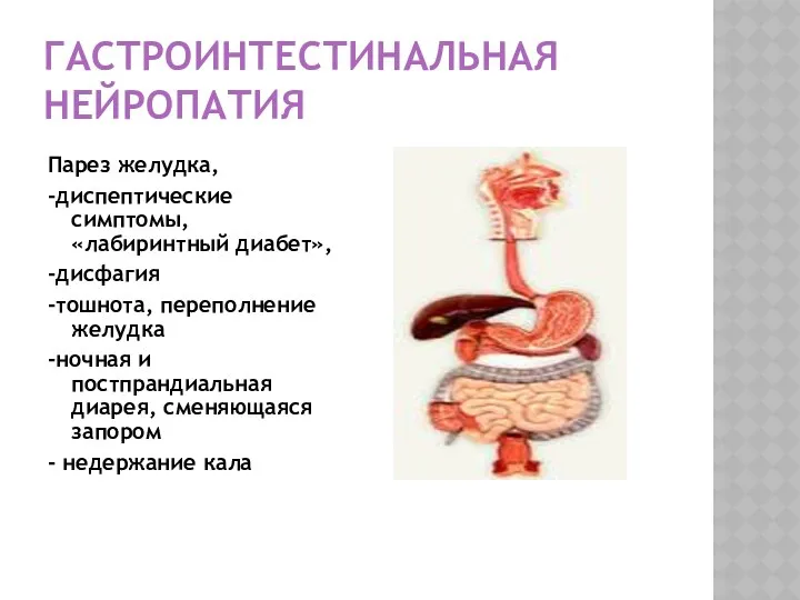 ГАСТРОИНТЕСТИНАЛЬНАЯ НЕЙРОПАТИЯ Парез желудка, -диспептические симптомы, «лабиринтный диабет», -дисфагия -тошнота,