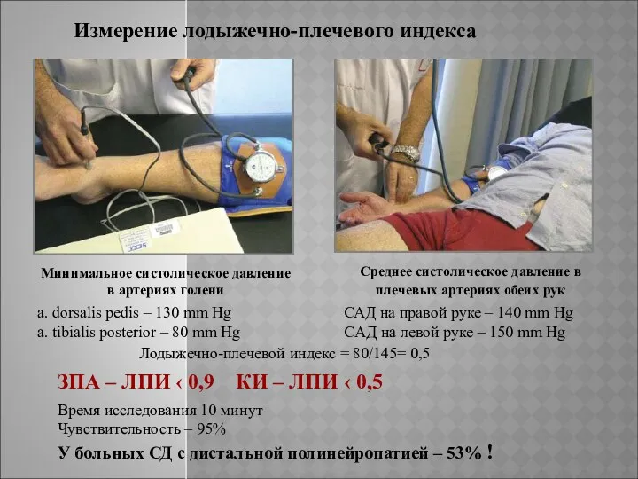 Измерение лодыжечно-плечевого индекса Минимальное систолическое давление в артериях голени Среднее