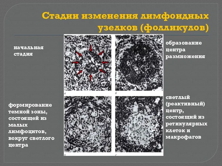 Стадии изменения лимфоидных узелков (фолликулов) начальная стадия образование центра размножения