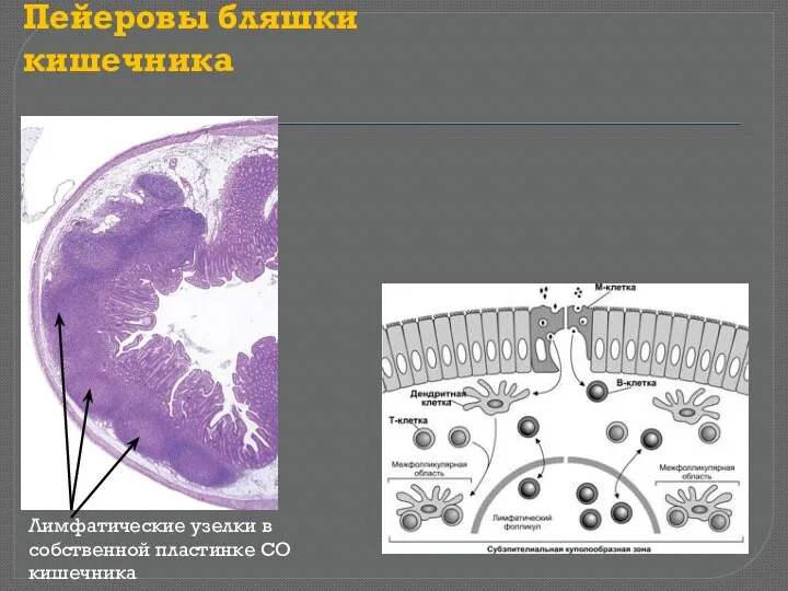 Пейеровы бляшки кишечника Лимфатические узелки в собственной пластинке СО кишечника