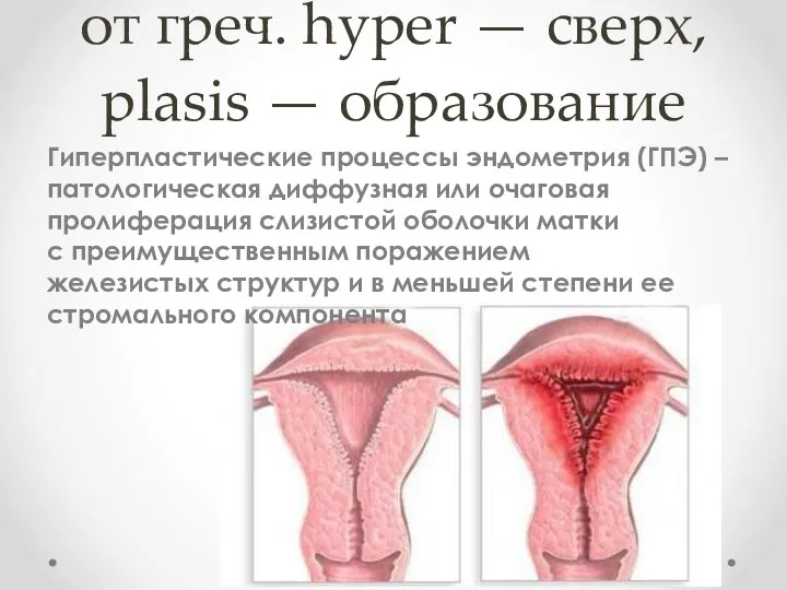 от греч. hyper — cверх, plasis — образование Гиперпластические процессы эндометрия (ГПЭ) –патологическая