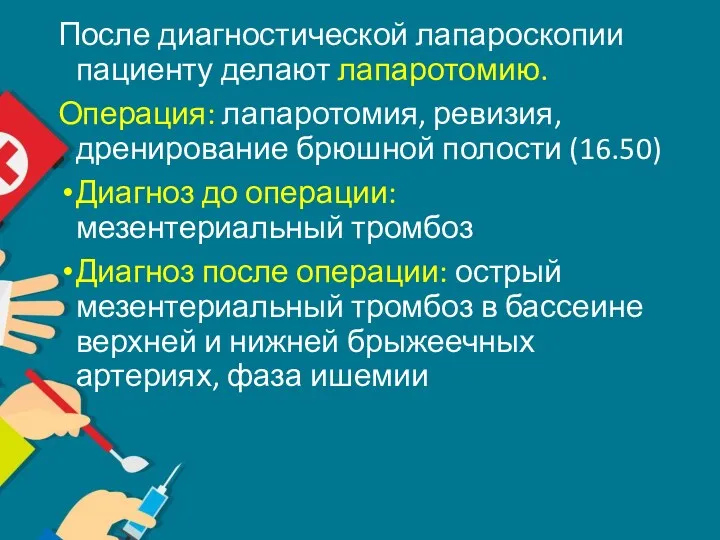 После диагностической лапароскопии пациенту делают лапаротомию. Операция: лапаротомия, ревизия, дренирование брюшной полости (16.50)